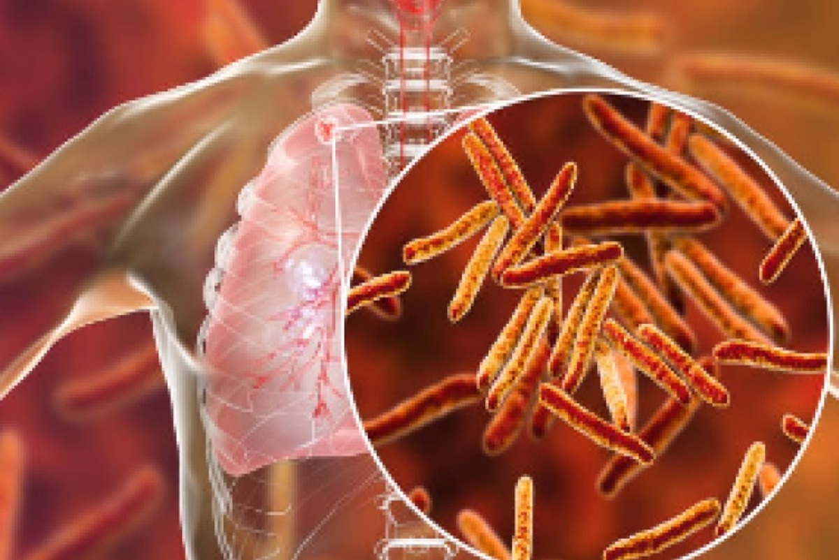 tuberculosis-therapeutics-market